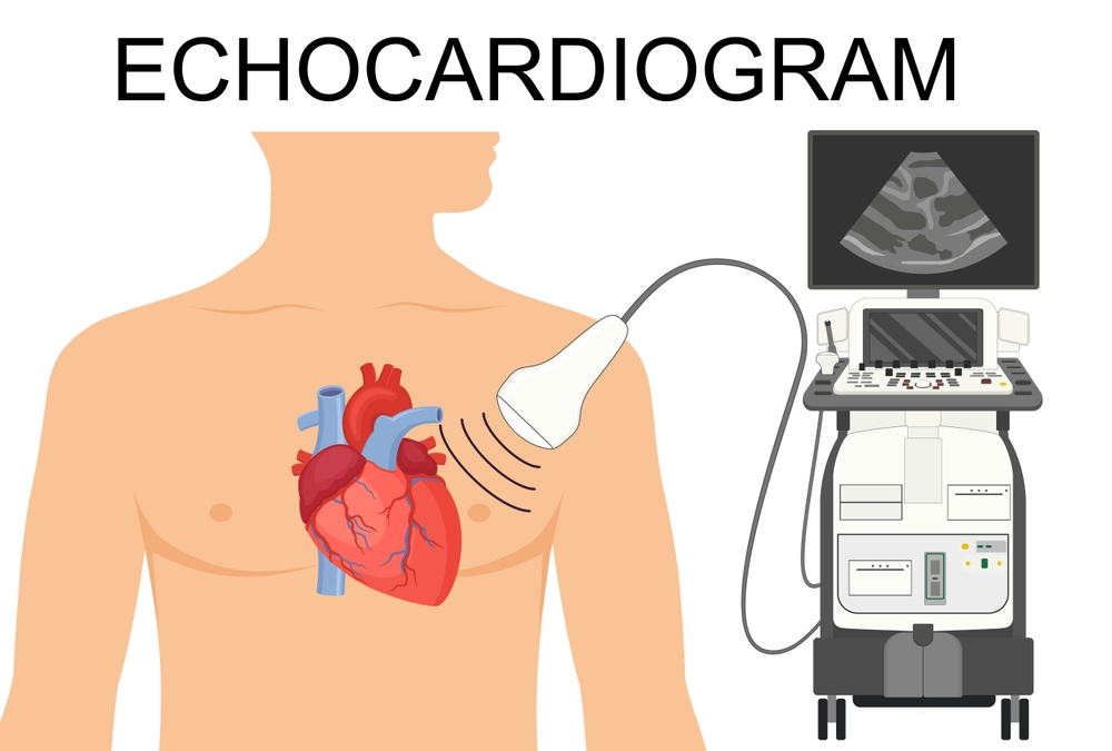 Types of Echocardiography