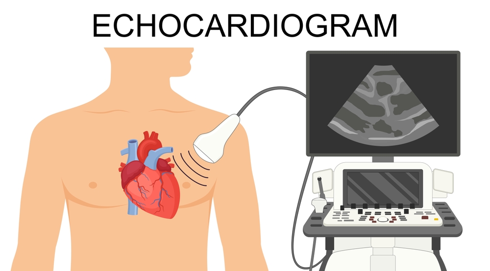 Echocardiography