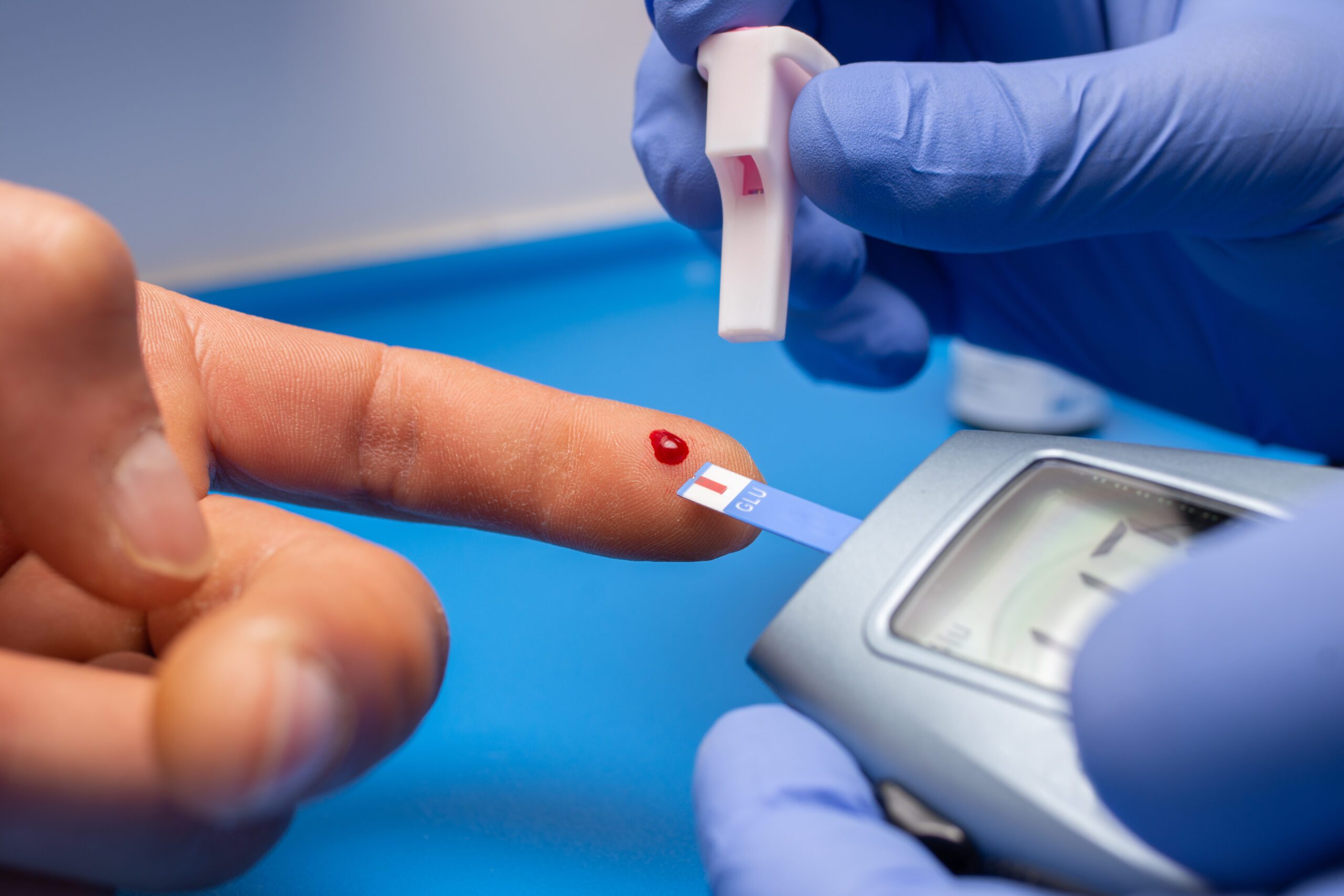 Managing Type 2 Diabetes with Diabetologist Consultation in Bangalore